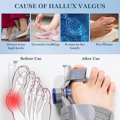 Bunion Corrector